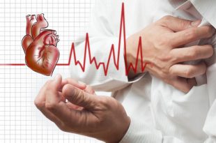 Ê-kíp can thiệp tim mạch Bệnh viện 19-8 cứu sống bệnh nhân ngưng tim
