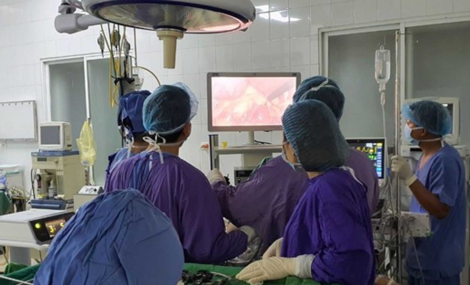 Bệnh viện 19-8 lần đầu tiên phẫu thuật cắt u gan bằng nội soi ít xâm lấn
